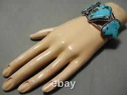 Chunky Huge Vintage Navajo Old Morenci Turquoise Sterling Silver Webbed Bracelet