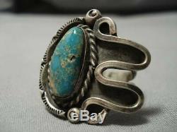 Important Fox Turquoise! Vintage Navajo Sterling Silver Ring Old