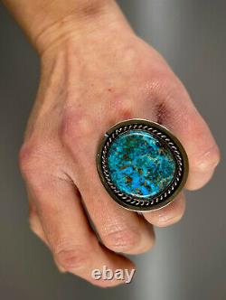 MASSIVE Vintage Navajo HEARTY Sterling Silver Blue Turquoise Ring 27 Grams