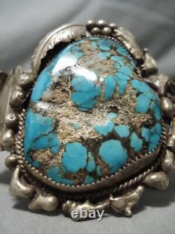 One Of Best Vintage Navajo Spiderweb Turquoise Sterling Silver Watch Bracelet