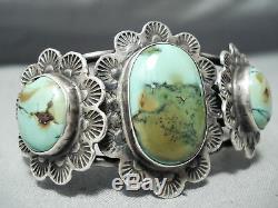 Shocking Vintage Navajo Domed Royston Turquoise Sterling Silver Bracelet